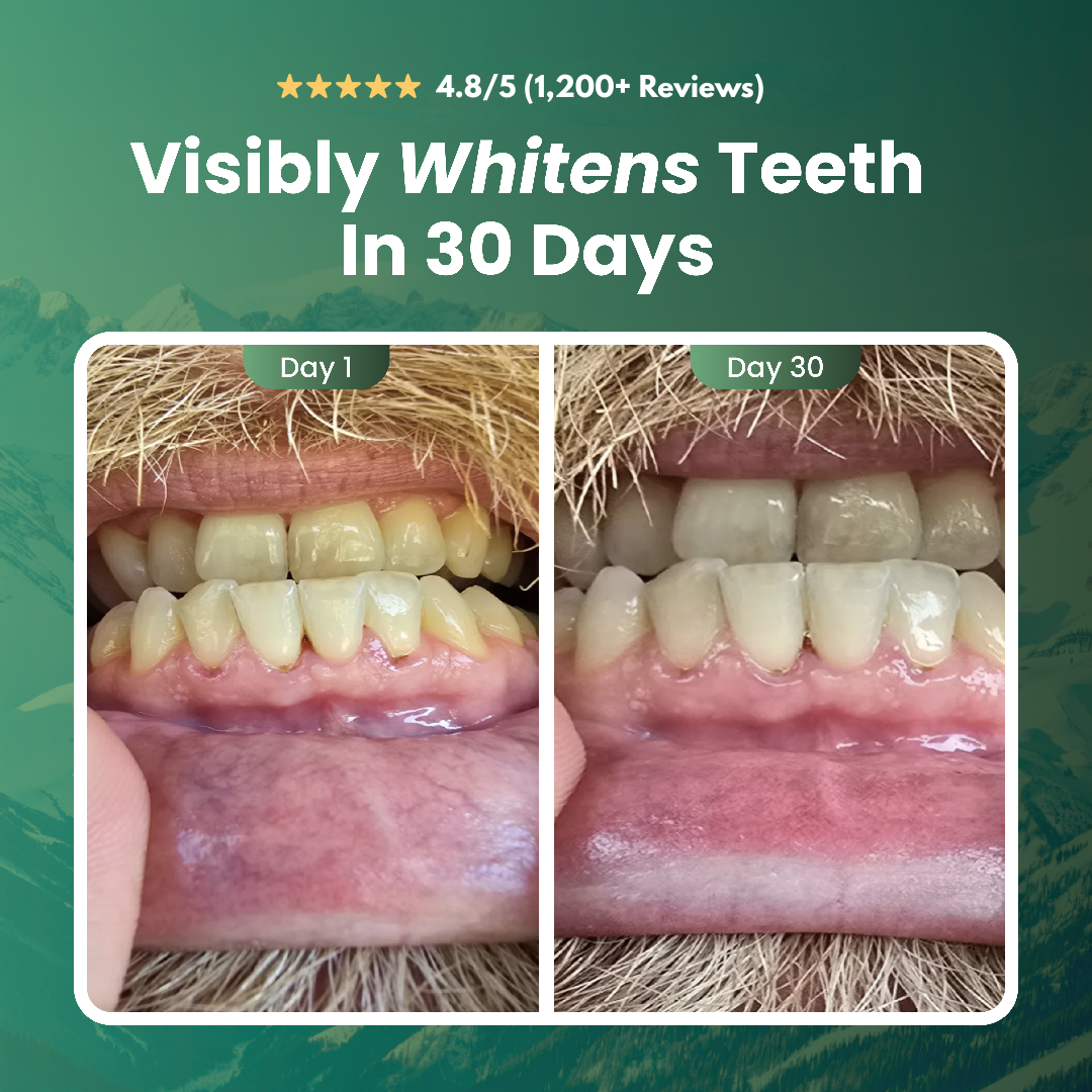 Enavell™ Remineralizing Gum